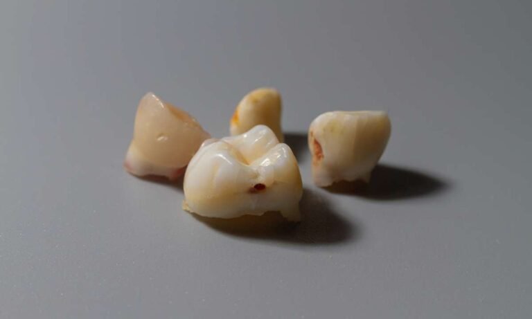 Dream About Teeth Falling Out? The Truth You Need to Know