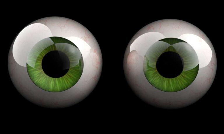 Dream About Eyeballs? Uncover Its Deep Symbolism