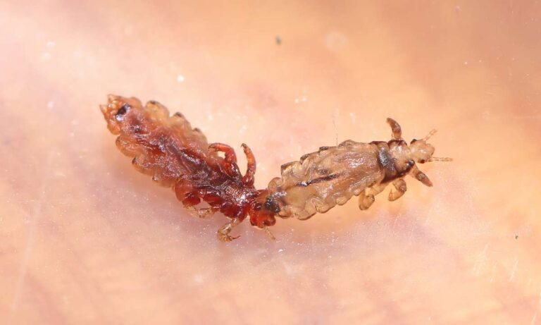 Exploring Dream About Head Lice