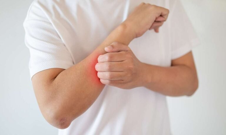Dream About Itching Body (Unlock 4 Surprising Reasons)