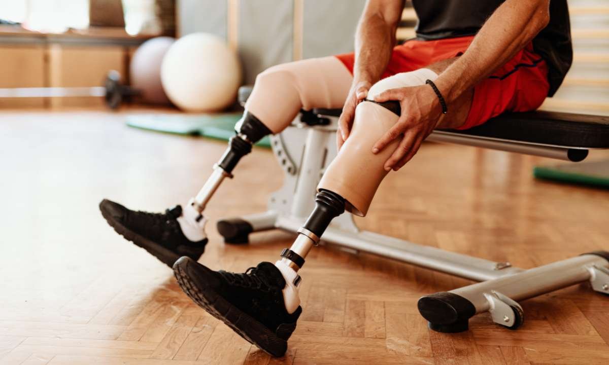 Dream About Someone Else Losing Limbs (4 Key Insights)