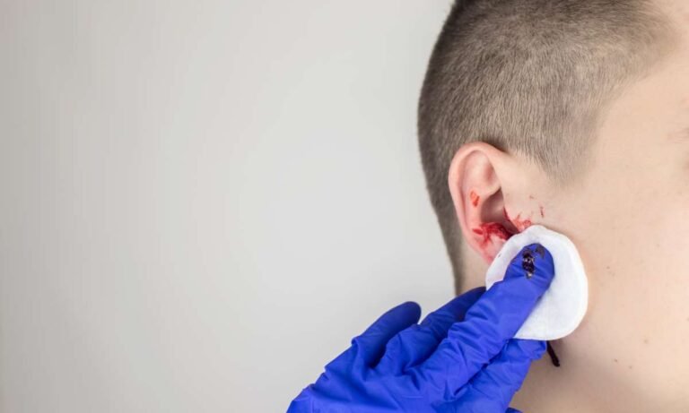 Dream About Ears Bleeding (18 things It Could Signify)