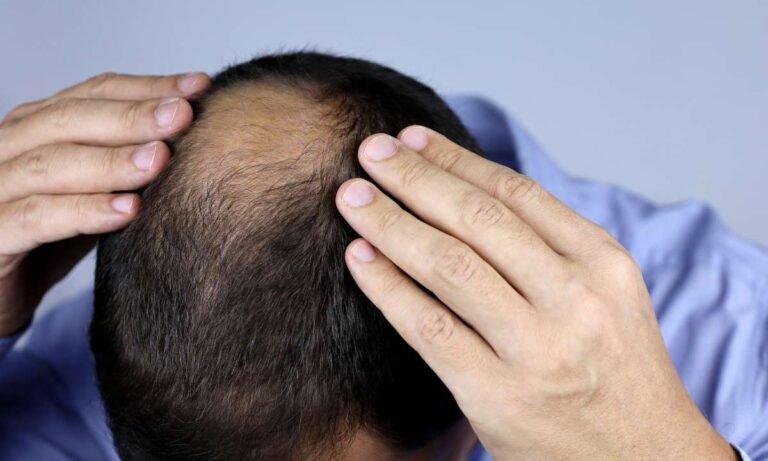 dream about hair loss in islam